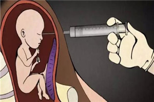 堕胎多久可以再次怀孕？人流后如何快速恢复